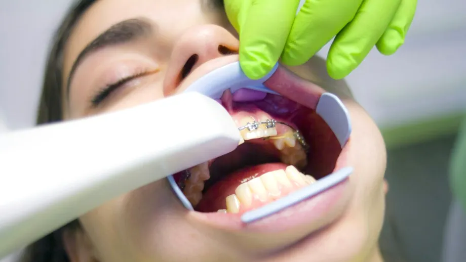 Inovații în tratamentul ortodontic. De la diagnostic la aparate dentare care reduc durata de tratament cu minimum șase luni