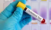 Când trebuie să testăm pentru colesterol copiii mai mici de 10 ani