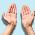 Ce probleme de sănătate pot ascunde palmele tale. Semnele pe care nu ar trebui să le ignori