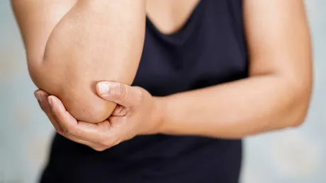 Semnul ciudat din cot că ai prea mult acid uric în sânge