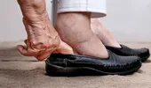 Glezne umflate: 8 probleme medicale semnalate prin picioarele umflate