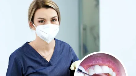 Medic stomatolog: Am avut mulți pacienți care nu făcuseră niciodată un detartraj