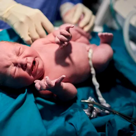 Bebelușii născuți cu această greutate riscă să facă AVC la vârsta adultă. Riscul e cu 21% mai mare