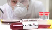 Program de testare gratuită pentru depistarea infecției cu virusuri hepatitice B și C în România