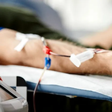 Dializa: ce este, când este necesară și cum funcționează acest tratament în boala de rinichi