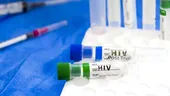 Pacient cu HIV, vindecat după un transplant de celule stem! Cazul a revoluționat lumea medicală din Germania