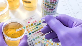 Ceaiul care ajută la ameliorarea infecțiilor urinare. Remediul vechi folosit de bunici pentru sănătatea rinichilor