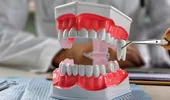 Sănătatea gurii este esențială pentru sănătatea întregului organism. 11 moduri în care afecțiunile dentare îți influențează starea de bine