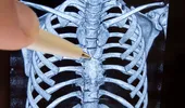 Organul misterios din corp care ar asigura longevitatea și ar putea acționa împotriva cancerului. I se mai spune și „sediul sufletului” sau „cimitirul de celule”