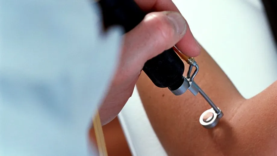 Epilarea definitivă cu laser: o creştere cu 25% în rândul bărbaţilor din România