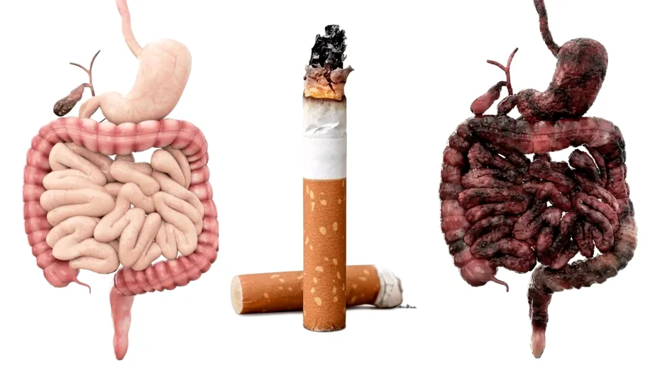 Fumatul - cum îți distruge stomacul și ficatul. Fiecare țigară îți răpește 11 minute din viață