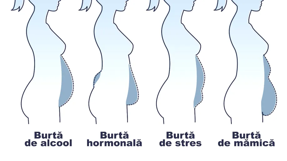 4 tipuri de burtă, în funcție de formă: care sunt cauzele și soluțiile lor