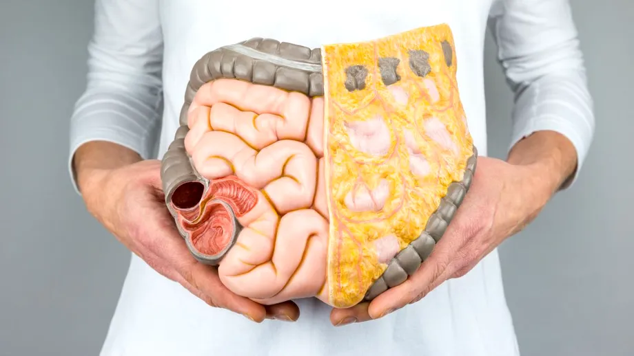 Semne ale cancerului de colon la tineri. Avertismentul transmis de un medic gastroenterolog