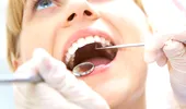Tu ce ştii despre implantul dentar?