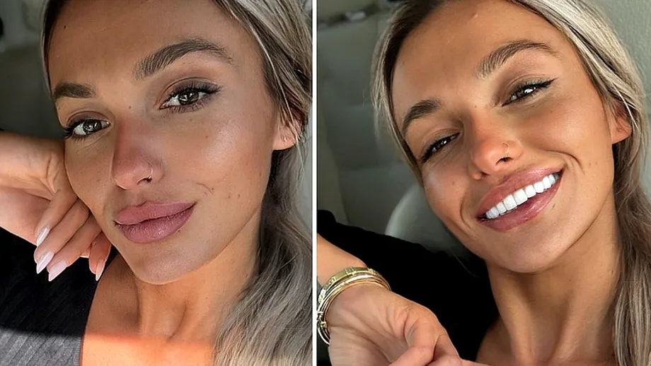 Câte operații estetice are Ella Vișan, iubita lui Andrei de la Insula Iubirii! Se confruntă cu probleme medicale după intervenții