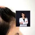 Cauzele reale ale căderii părului la femei și bărbați. Când să mergi la medic