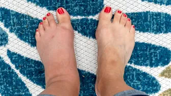 Semnele ascunse de pe picioare care pot indica probleme grave de sănătate. La ce trebuie să fii atent