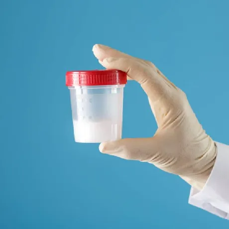 Poate o spermogramă realizată acasă să indice fertilitatea masculină?