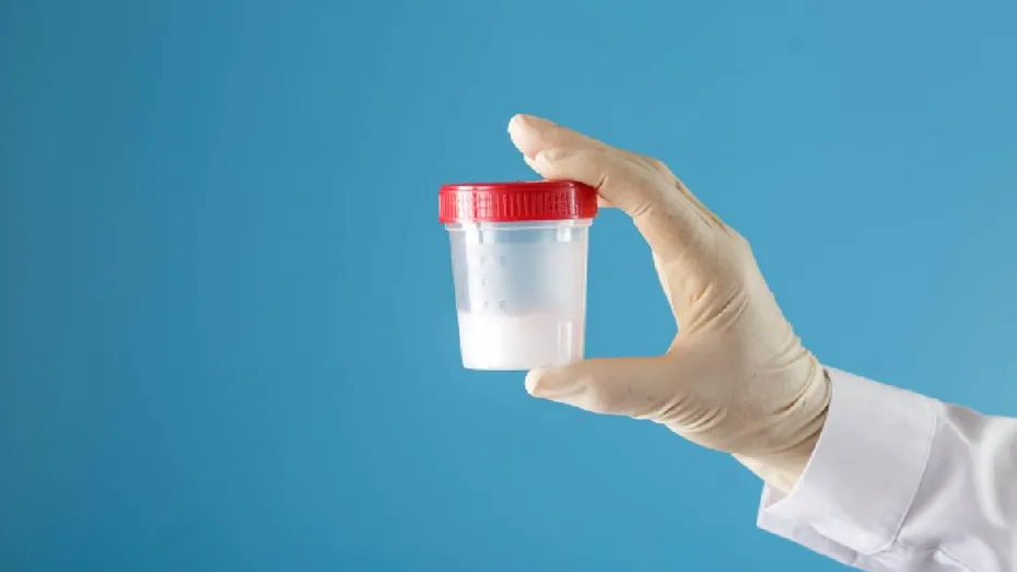 Poate o spermogramă realizată acasă să indice fertilitatea masculină?