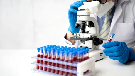 Cancerul ar putea fi detectat în stadiu incipient datorită unui nou test de sânge. Metoda inovatoare descoperită recent