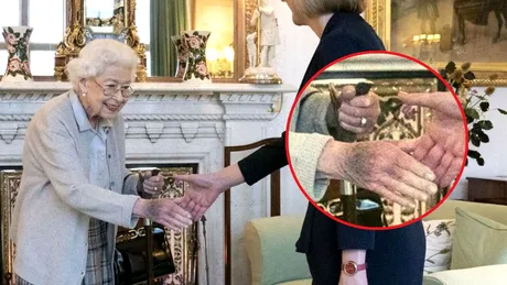 Boala de care suferea regina Elisabeta a II-a. Detaliul pe care l-a observat un medic pe mâinile suveranei cu o zi înainte să moară