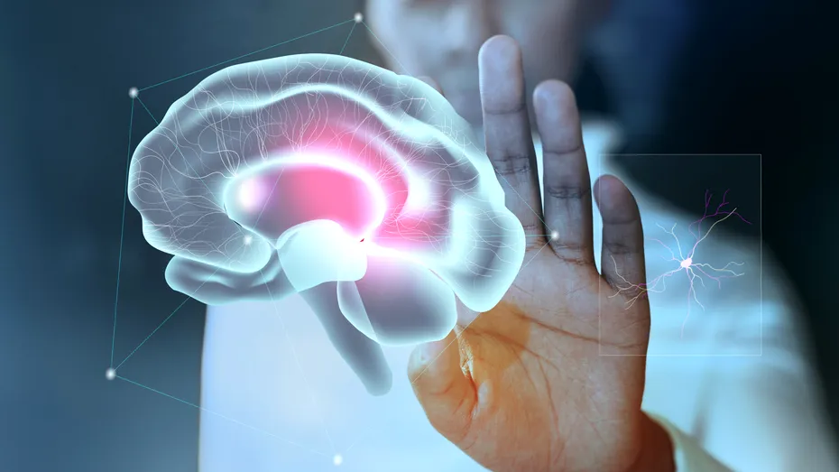 Accidentul vascular cerebral silențios, boala pe care nici nu știi când o ai