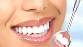 Secretele zâmbetului perfect: faţetele şi coroanele dentare VIDEO by CSID