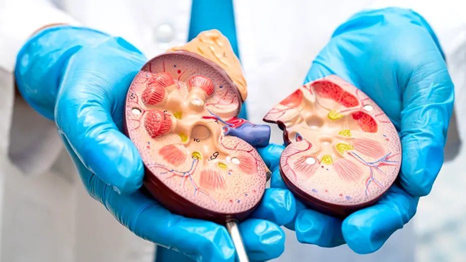 Cum să elimini natural pietrele la rinichi. Rețete care te ajută să previi recurența