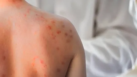 Pielea care „ține minte” stresul: cum se vede anxietatea pe ten
