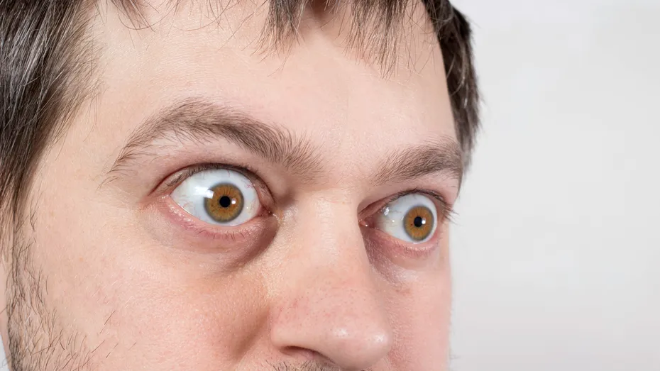 8 boli care ți se citesc în privire. Ce semne dau ochii când ai un AVC sau probleme cu ficatul ori tiroida