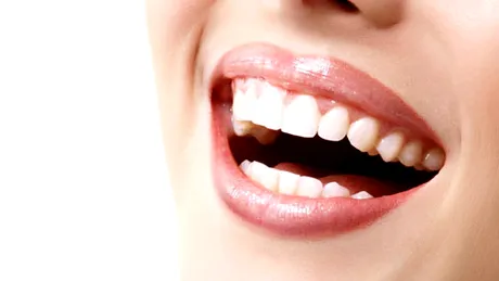 Dinţi mai albi – cum îi poţi avea?