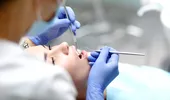 Servicii stomatologice decontate de CNAS în 2026. Cum poți merge la dentist gratuit și ce tratamente sunt incluse?