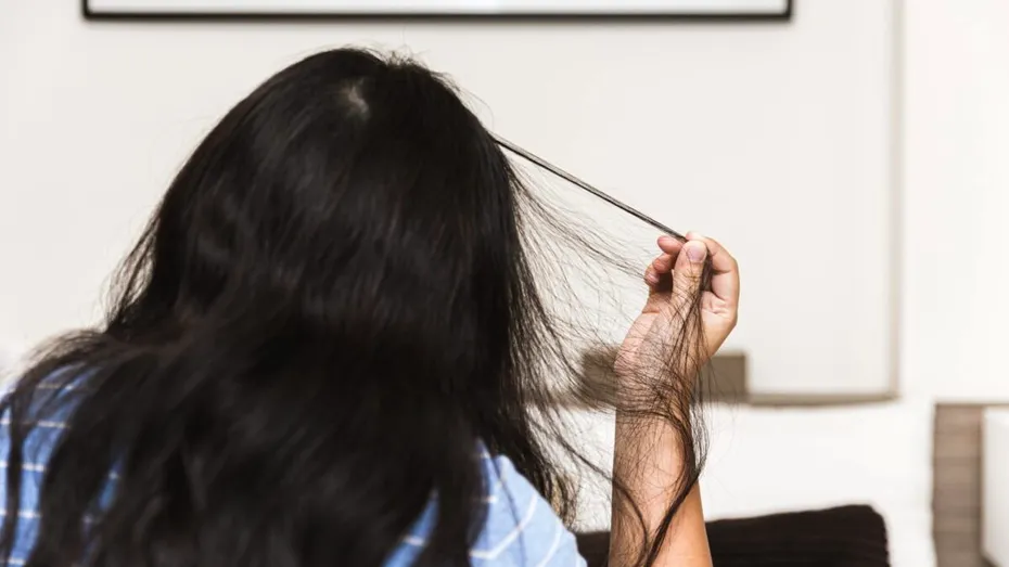 Tricotilomania: de ce apare tulburarea de smulgere a părului și cum poate fi tratată