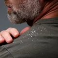 (P) Mătreață și seleniu: beneficii pentru microbiomul scalpului